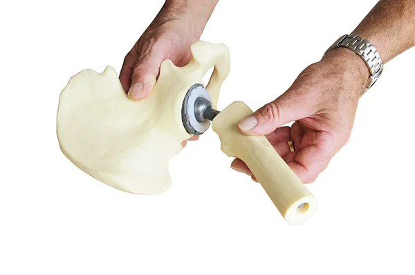 Medical implant held in man's hands